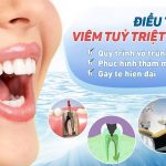 triệu chứng sau khi lấy tuỷ răng