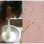 Thực hư câu chuyện con sâu răng và cách hành động đúng