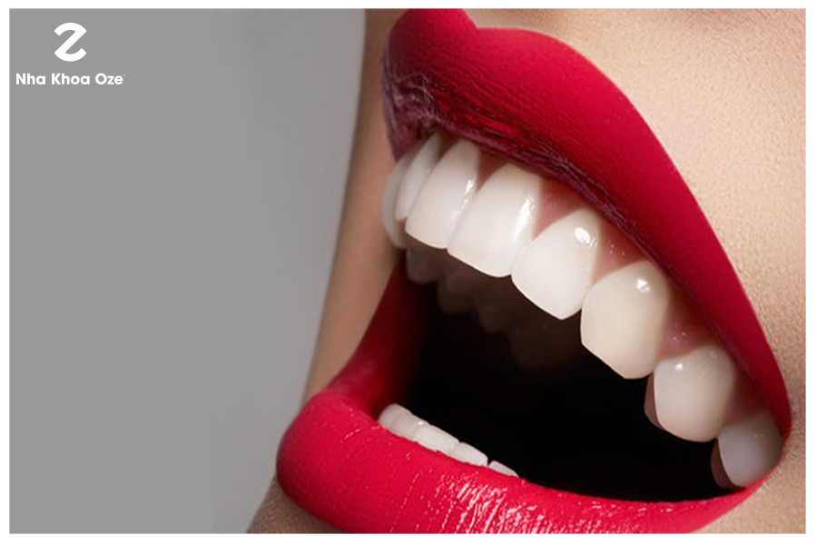 Có được hàm răng đều tăm tắp, trắng, khỏe đẹp là mong muốn của rất nhiều người
