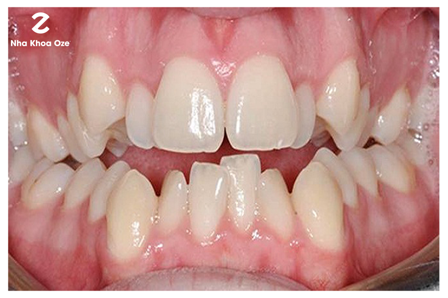 Đến với hình ảnh này, bạn sẽ khám phá ra những vấn đề răng miệng thường gặp và học được những kinh nghiệm giải quyết chúng. Cùng nhau thực hiện những phương pháp đơn giản để có một hình răng đẹp và khỏe mạnh.